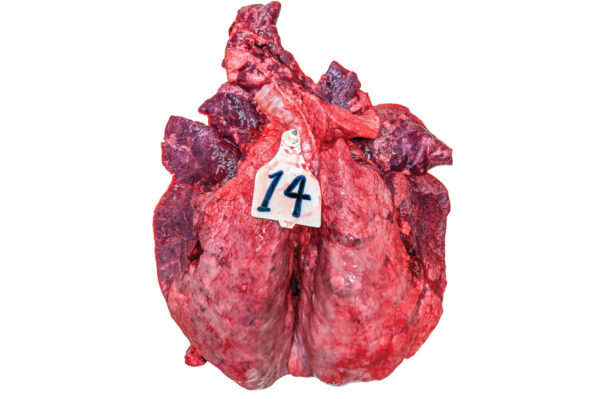 БРСВ не просто повреждает клетки лёгких, он вызывает сильное воспаление во всех лёгких